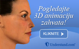 3D animacija korekcija nosa